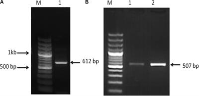 Expression Profiling of Lipolytic and Long-Chain Fatty Acid Biosynthesis Genes in Catfish Larvae Fed With Graded Lipid Levels